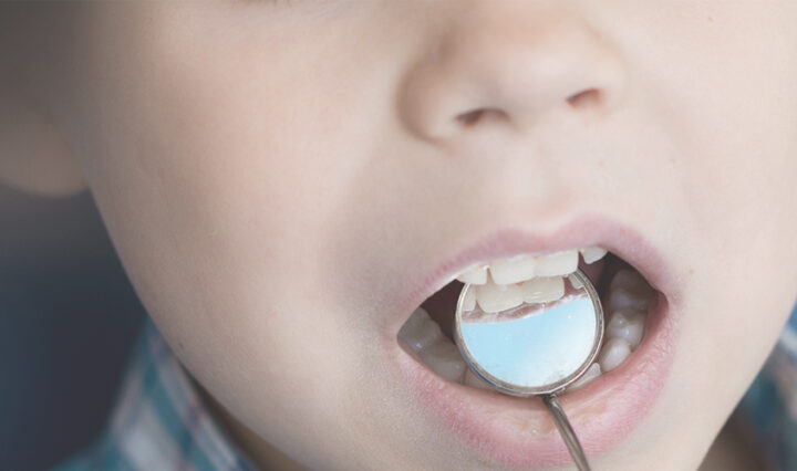 Preparing your child for their first visit to the dentist